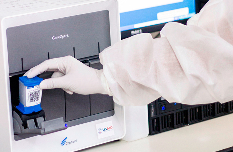 PCR TB (Gene Expert)