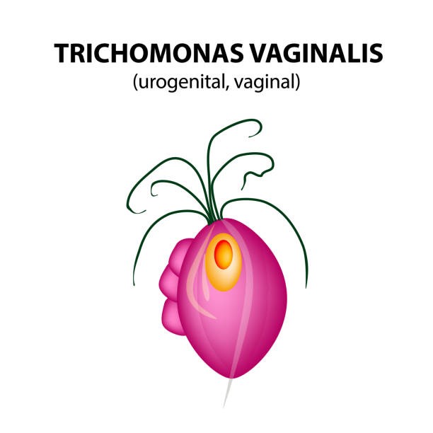 Trikomoniasis