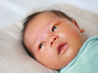 Breastfeeding & Breast Milk Jaundice