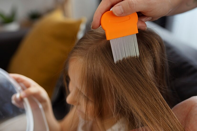 Yang Boleh dan Tak Boleh Dilakukan Jika Rambut Anak Kutuan