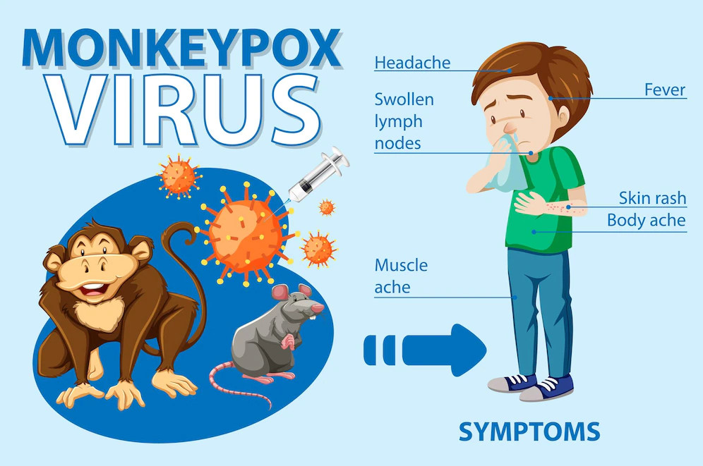 Ketahui Tahapan Perkembangan Cacar Monyet (Monkeypox) dari Masa Inkubasi Hingga Sembuh