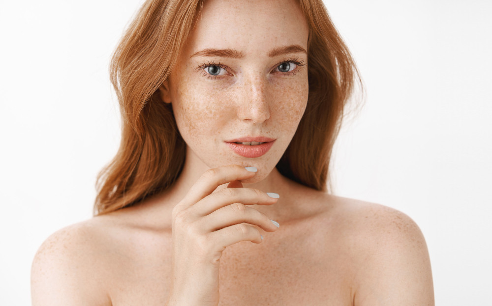 Sering Dianggap Sama, Ini Beda Freckles dan Flek Hitam pada Wajah